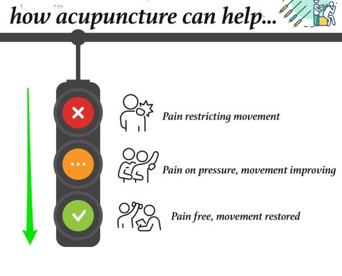 Traffic light system for acupuncture