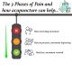 Traffic light system for acupuncture